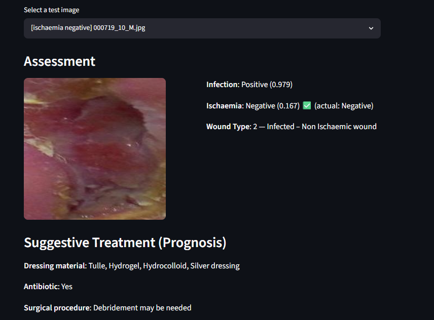 Wound Infection System